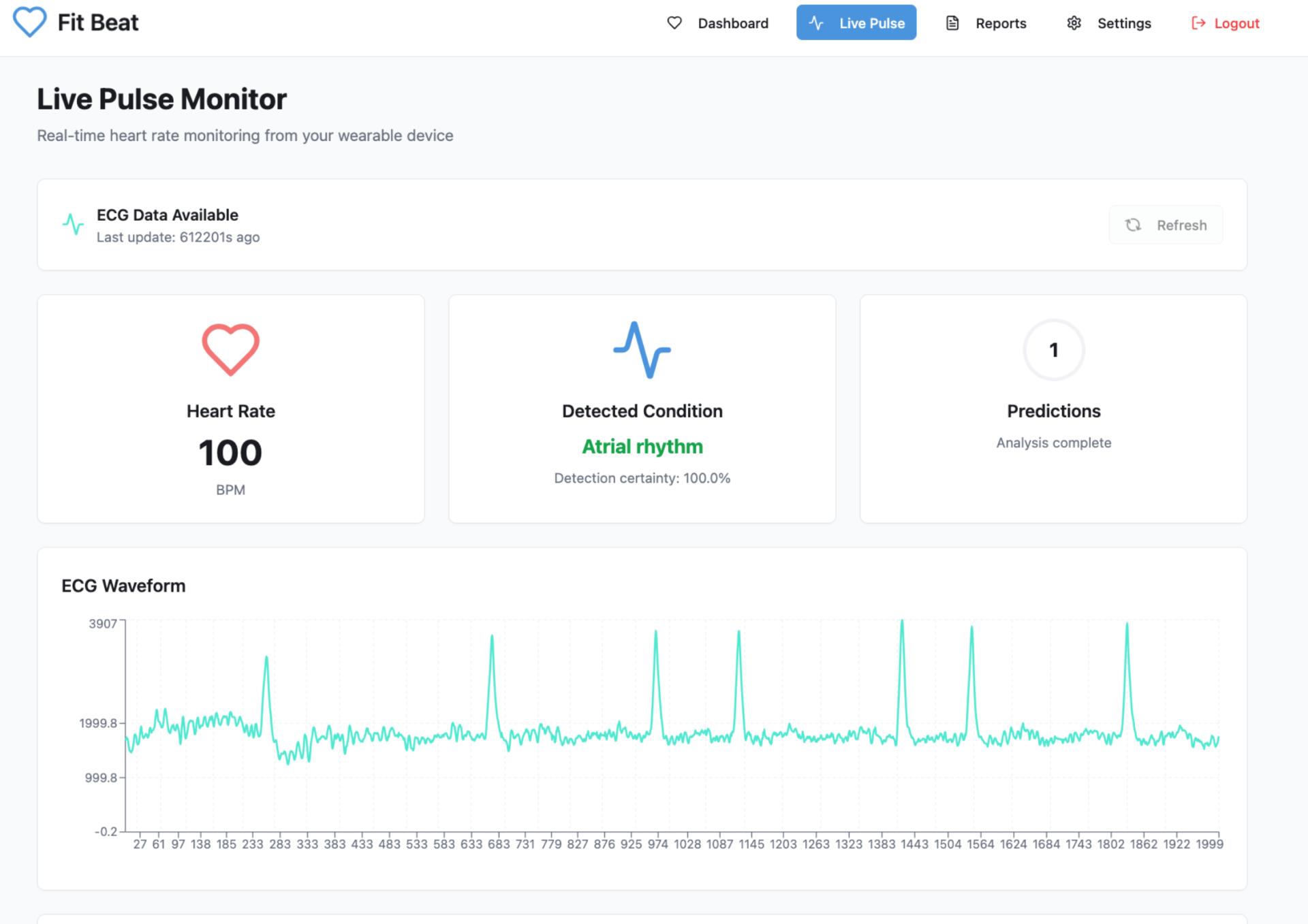 Fit Beat Real-Time ECG Dashboard
